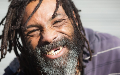 Common Causes of Missing Teeth