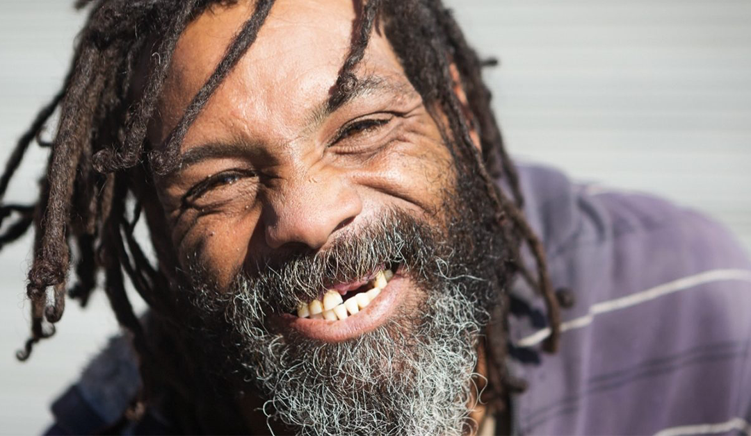 Common Causes of Missing Teeth