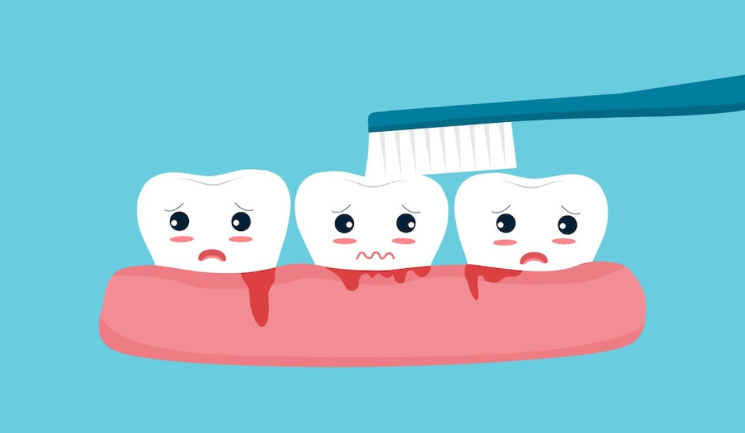Bleeding gums: Causes, symptoms, and treatment options