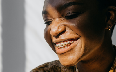 Common Myths About Cosmetic Dentistry